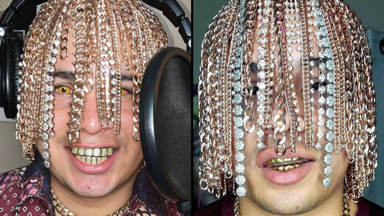 Rapper Dan Sur has apparently replaced his hair with gold chains after getting hooks 'surgically implanted' on his head for them to hang off. 