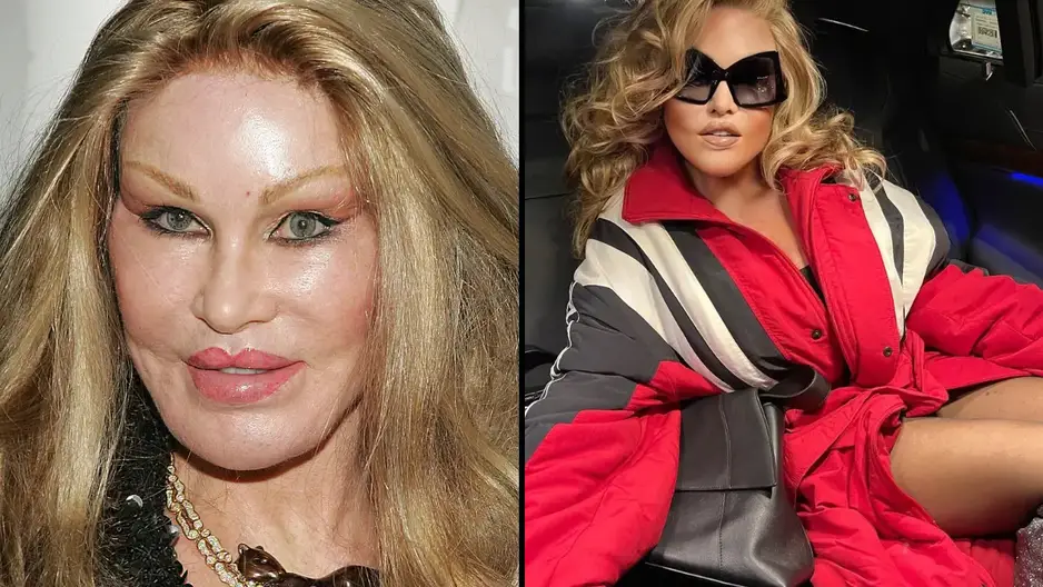 'Catwoman' Jocelyn Wildenstein, 84, has left her social media followers speechless after dropping age-defying snaps. 