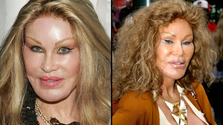 Jocelyn Wildenstein Shares Photo To Prove She's Not Had Plastic Surgery