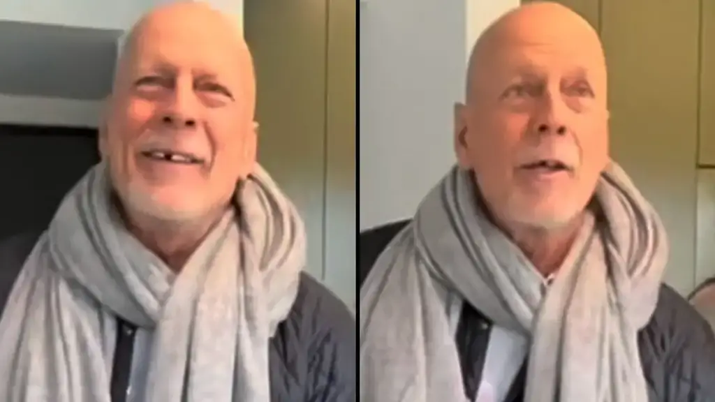 Bruce Willis' fans have been left alarmed after noticing that the legendary actor appears to be missing a tooth.