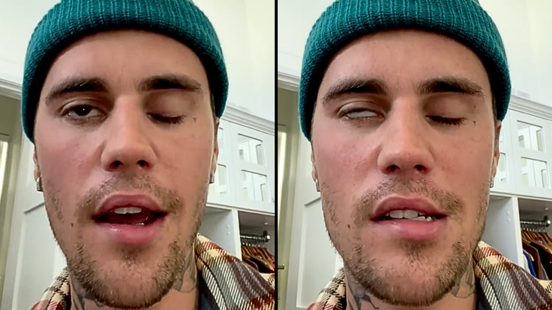 Justin Bieber has issued a health update on his Ramsay Hunt diagnosis with fans.