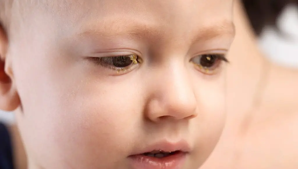 Eye sleep