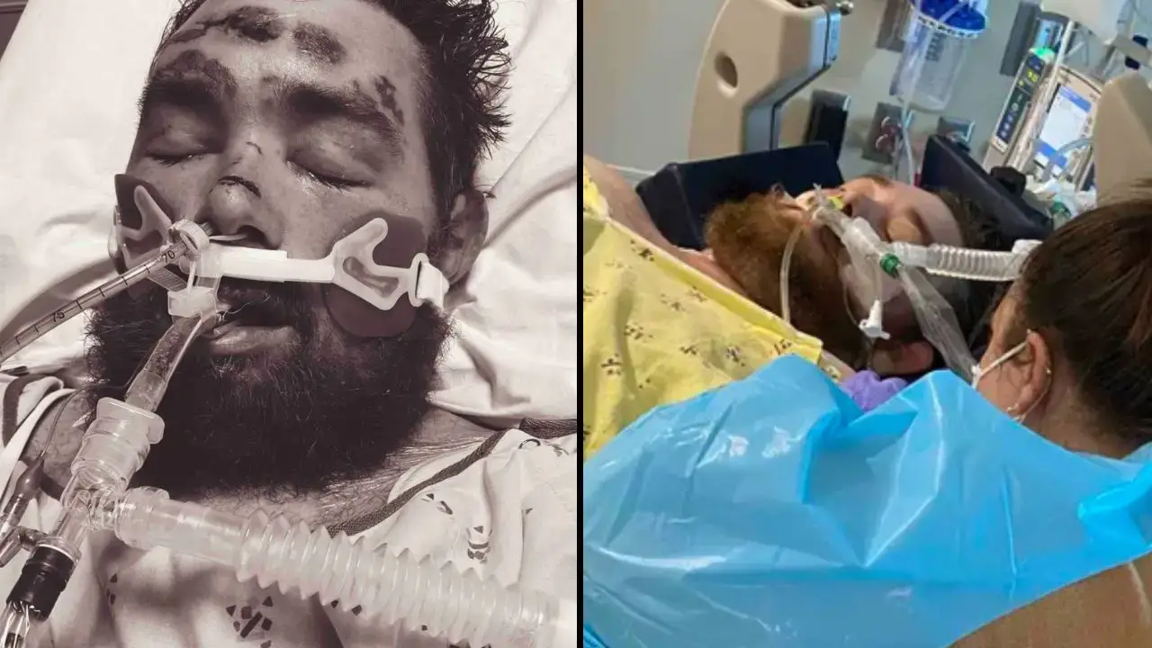 A man, named Steven Spinale, was left in a coma with a 4% chance of survival after catching sepsis from plucking out an ingrown hair.