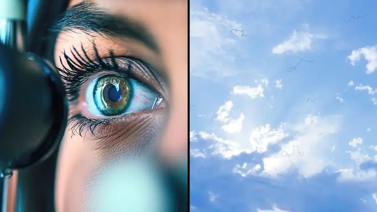 Experts have shared what to do if you see 'eye floaters,' the strange moving shapes that can effect your vision.