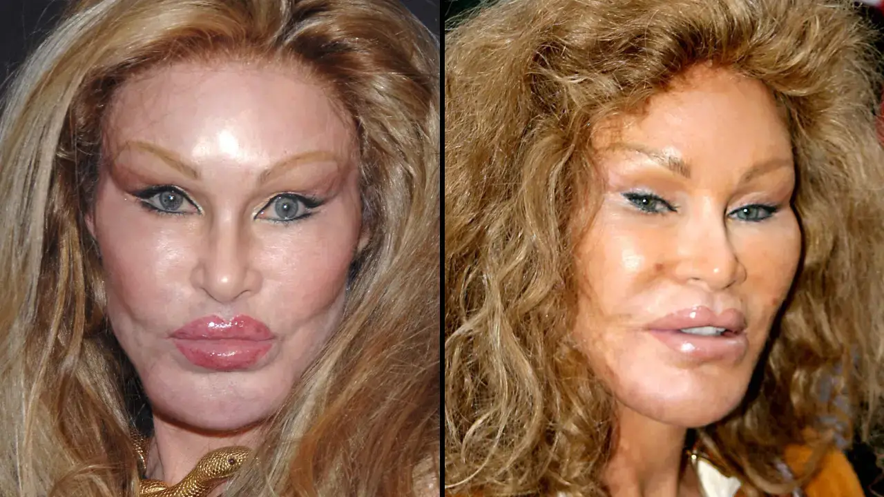 Jocelyn Wildenstein, 84, has hit back at the constant plastic surgery rumors.