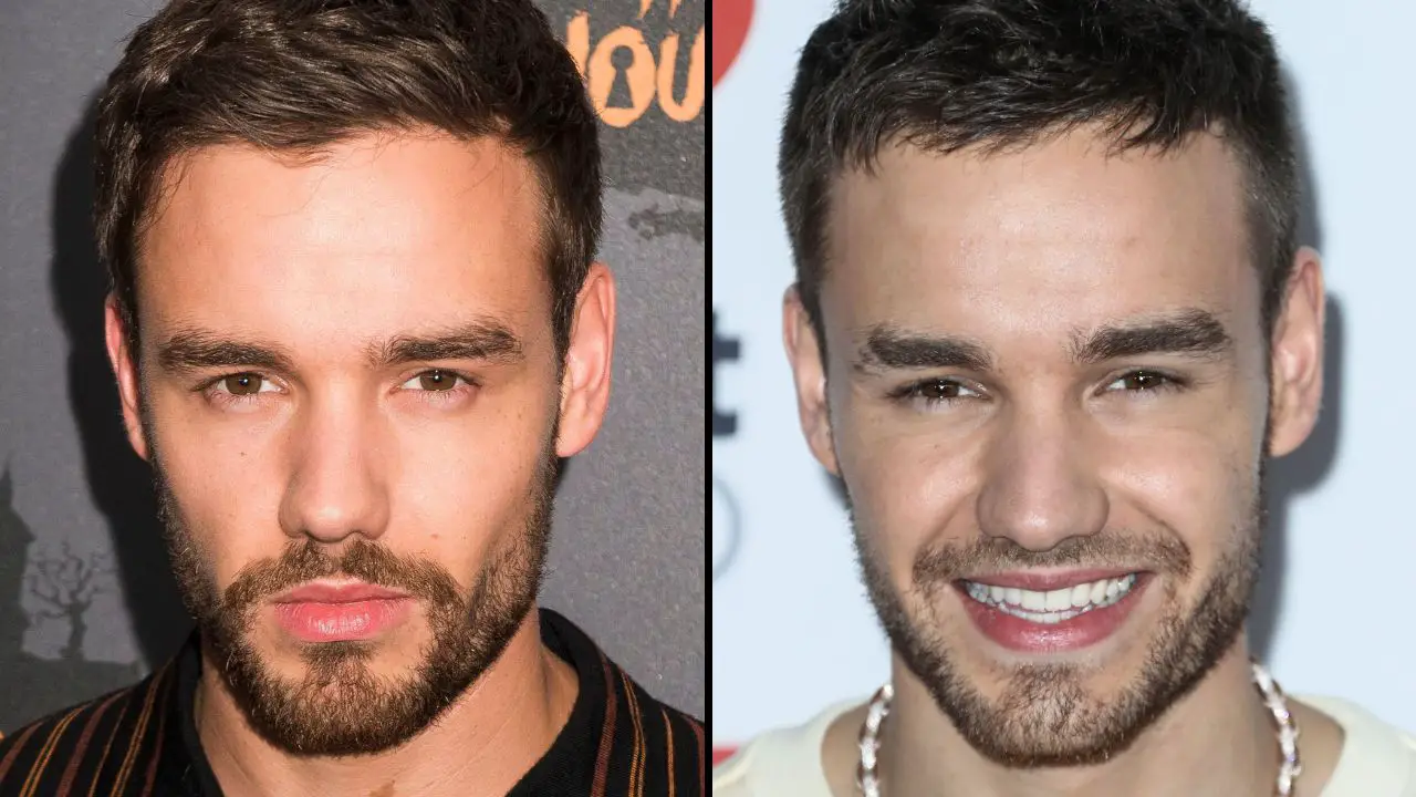 Liam Payne has tragically passed away at the age of 31, and his autopsy results have revealed some heartbreaking details.