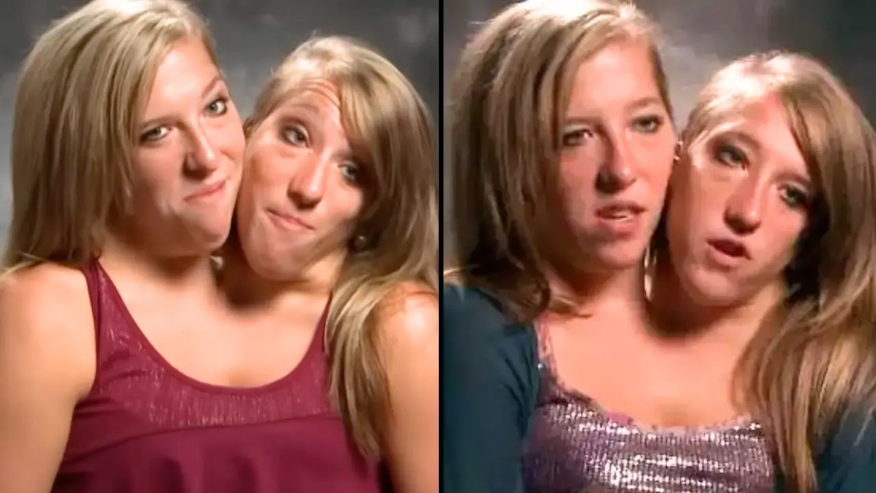 People have all been left with the same question after finding out that conjoined twin Abby Hensel has got married.