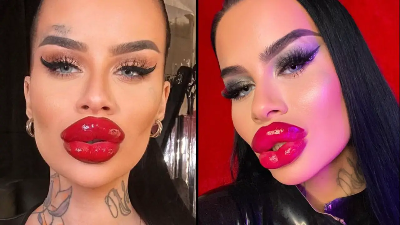 Fetisch Barbie, a model with huge lips, has revealed what she looked like before her extreme transformation. 