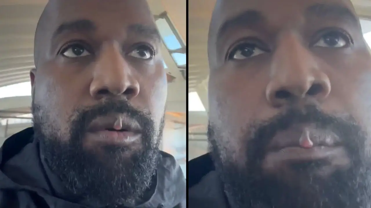 Kanye West has left fans concerned after sharing a video in which he can be seen with a lip 'growth'.