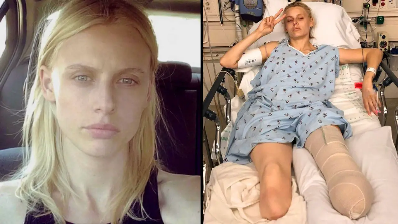 A woman named Lauren Wasser has lost her legs and almost died after using a tampon correctly.