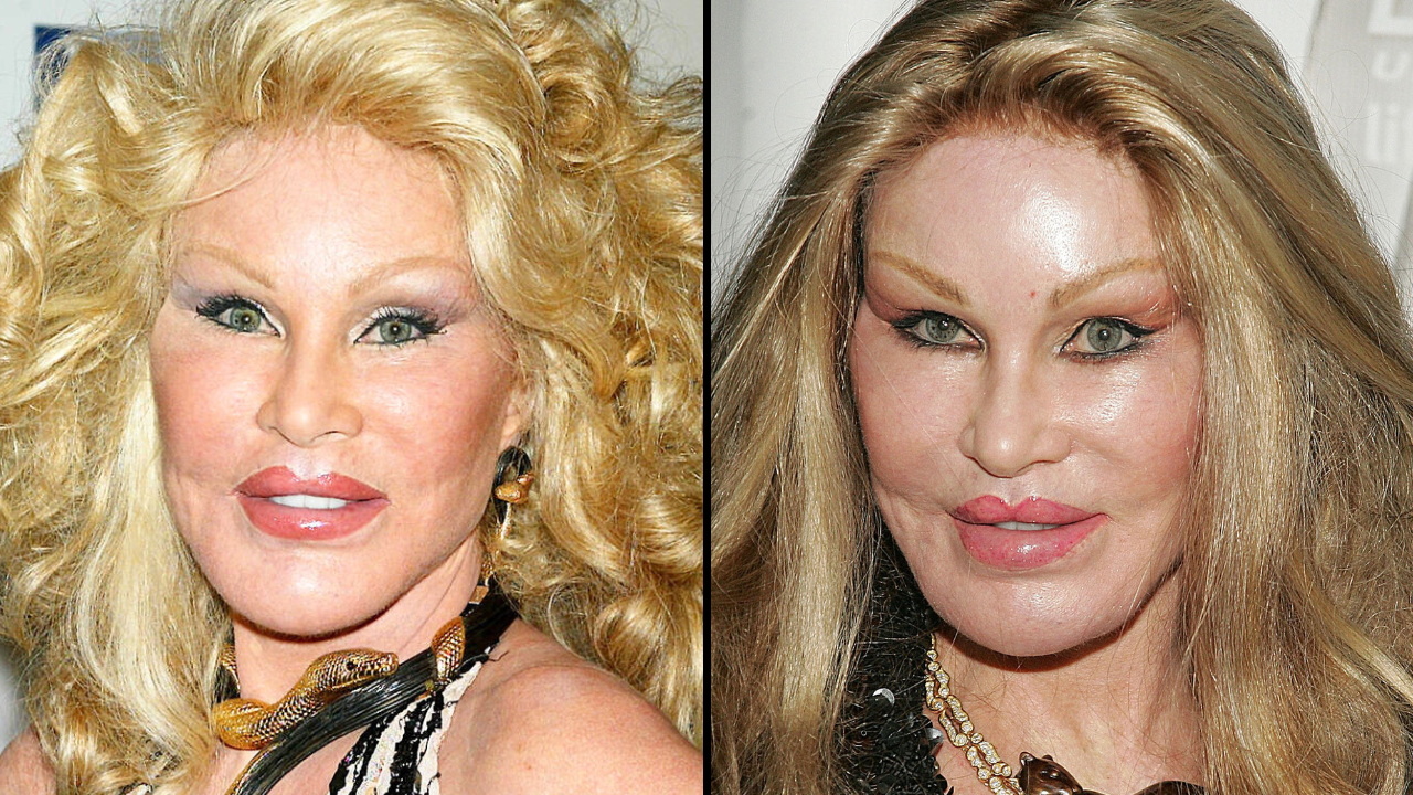 Socialite Jocelyn Wildenstein's cause of death has been confirmed by her fiancé.