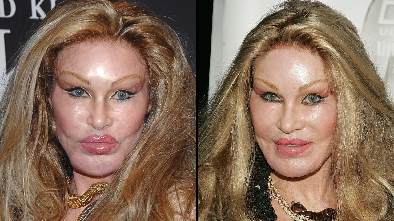 Jocelyn Wildenstein Dead: The socialite, widely known as 'Catwoman,' has passed away aged 84.