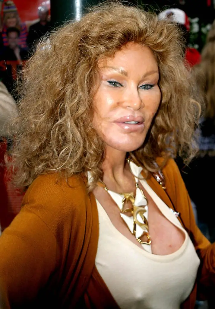 Jocelyn Wildenstein