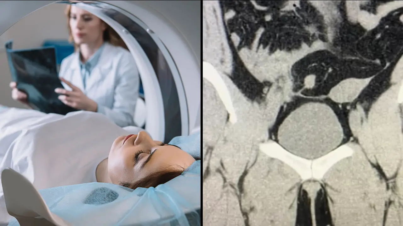 A woman has been left with major injuries after wearing an adult toy during an MRI scan.