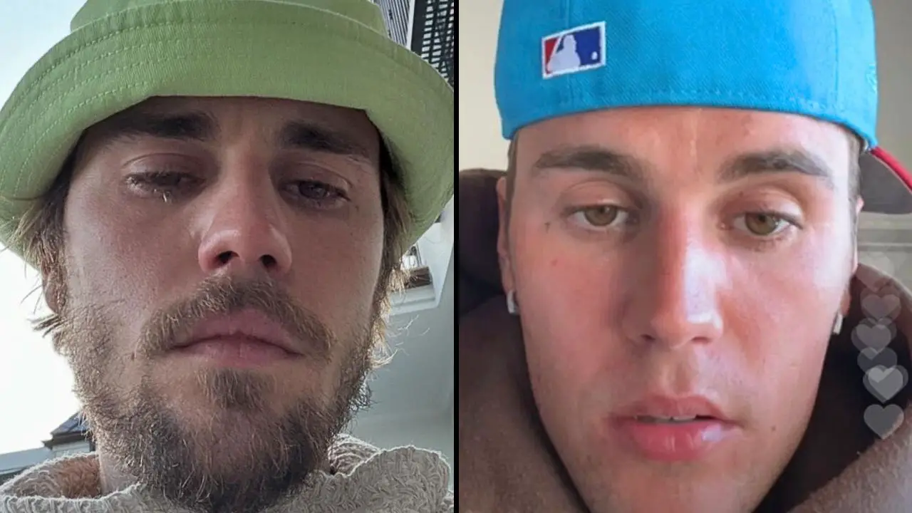 Justin Bieber fans are growing increasingly concerned for the singer's well-being after his change in appearance and cryptic Instagram posts.