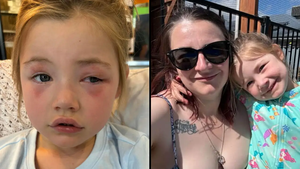 A four-year-old toddler was blinded in one eye after biting a laundry pod that her mom gave her to hold.