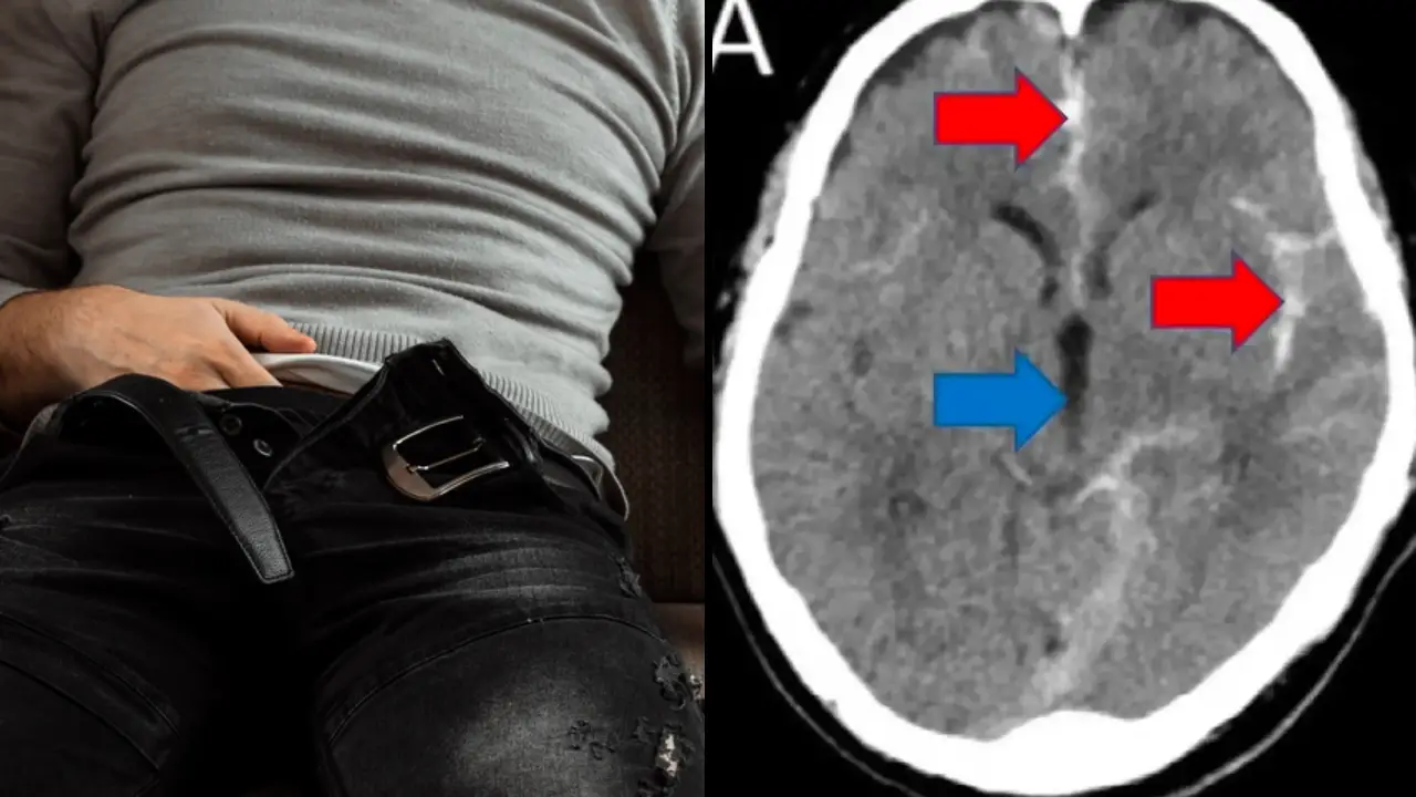 A 51-year-old single man in Japan almost pleasured himself to death after experiencing a near-fatal stroke immediately following e***ulation.