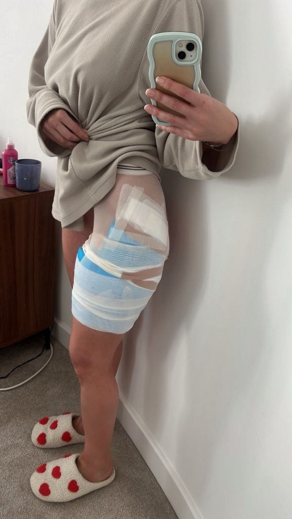 Annie Thomas' injury.