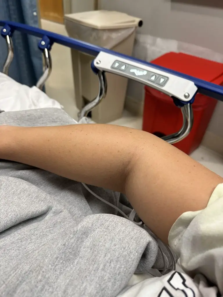 Jessica Johnson's arm.