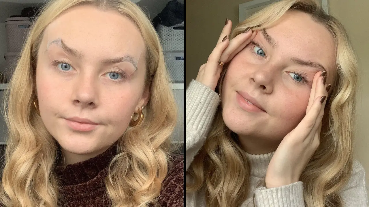 A woman suffers from a bizarre condition that means she has to tape or glue her eyes open.