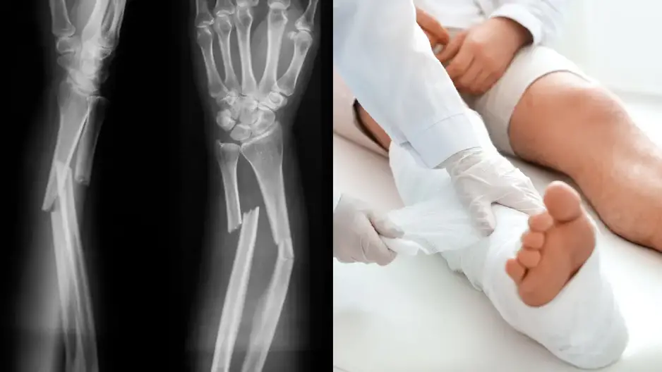 There is a weird theory about people who've 'never broken a bone' going viral on TikTok.