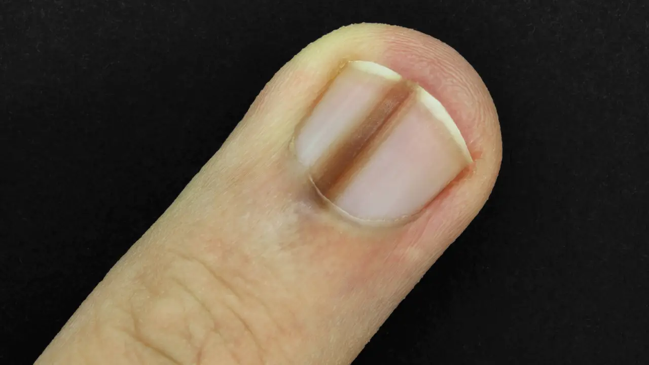 Despite having 'no symptoms' or pain, a man has sparked concern among strangers after posting a photo of his fingernail online.