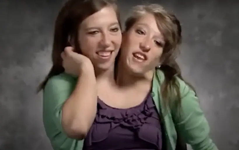 Abby and Brittany Hensel