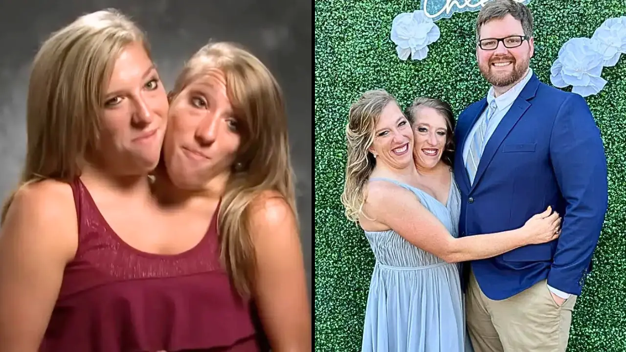 The mom of a famous pair of conjoined twins has answered the one question everyone always asks her - if her daughters could have kids.