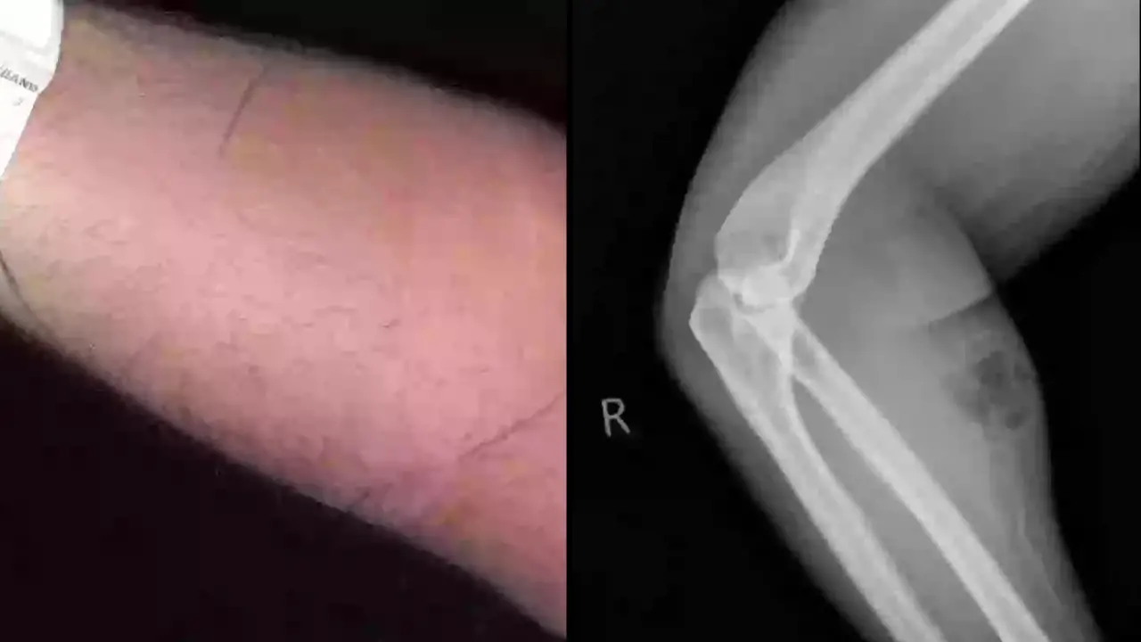 A man suffered horrific side effects after injecting himself with his own s***n. Find out more about the strange case here...