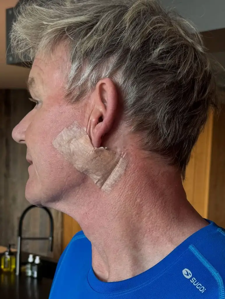 Gordon Ramsay cancer