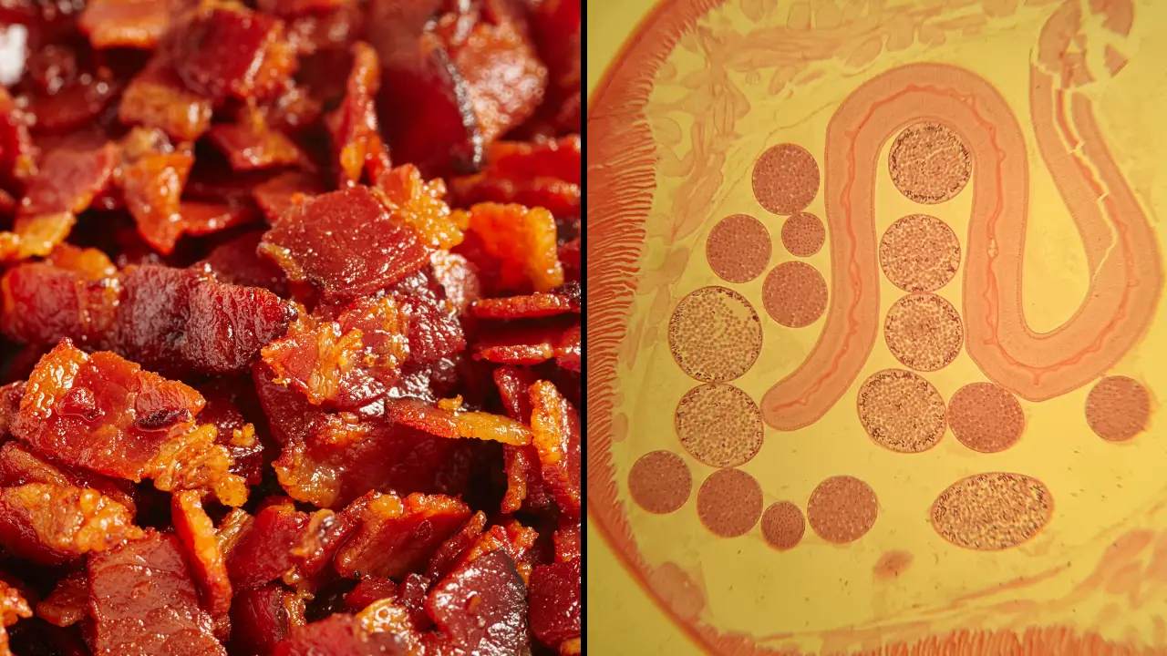 A man developed 'pork worms' in his brain after years of an unusual cooking habit.