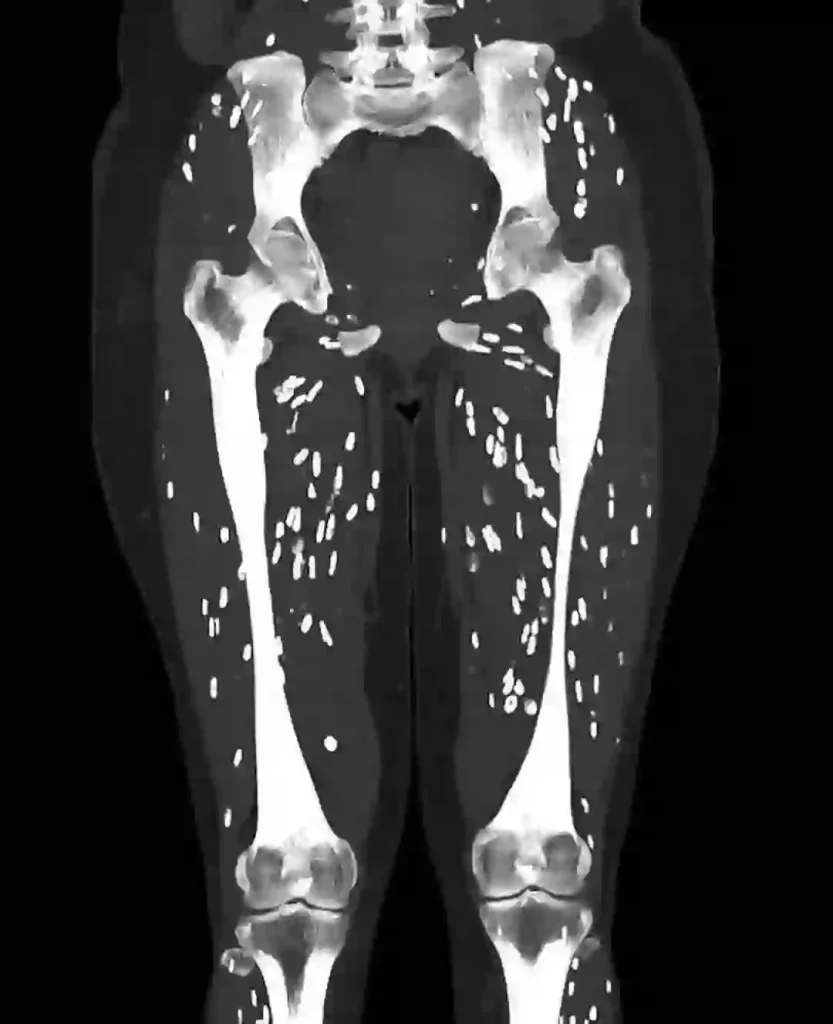 X-Ray