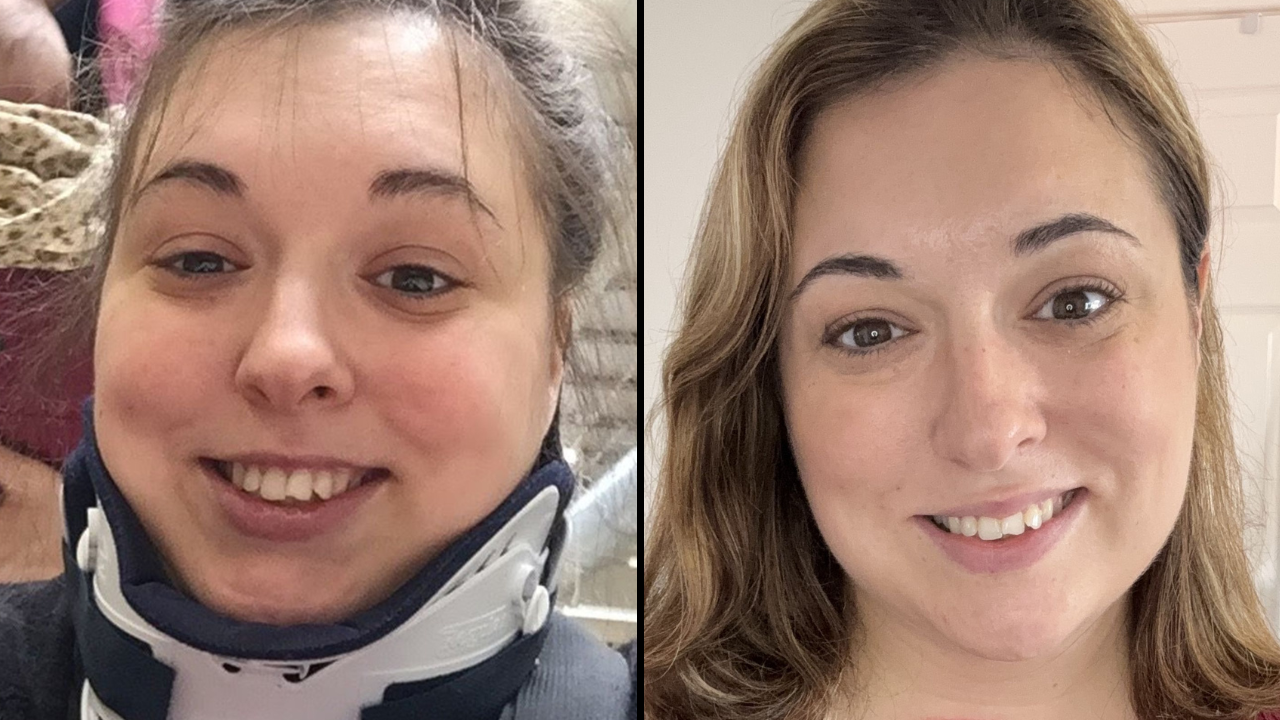 Urgent Warning Issued As Mom 'Nearly Dies' After Morning Yawn Was So 'Forceful' It Broke Her Neck