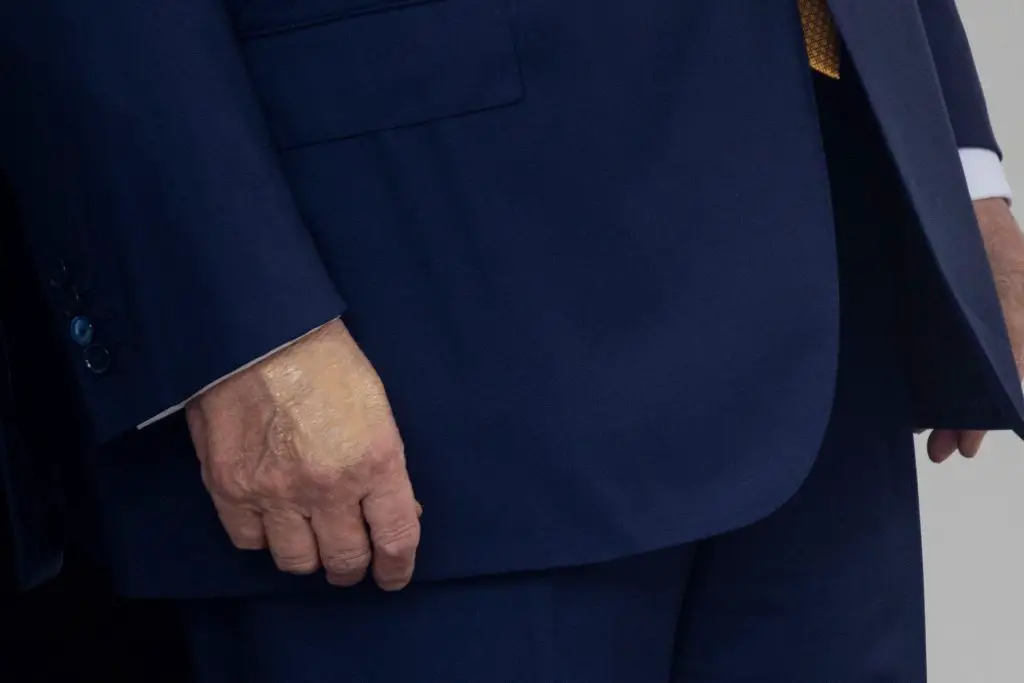 Trump's hand