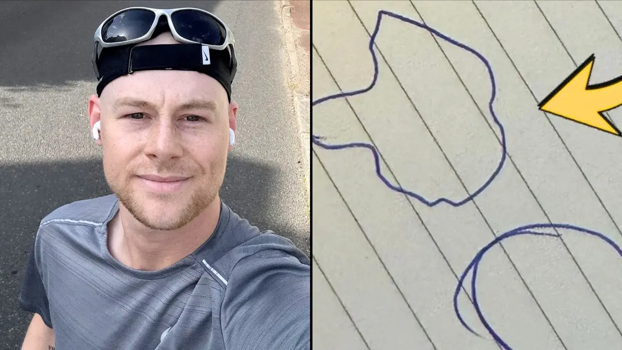 When Ed Baldwin's fiancée sketched what his private parts felt like, neither of them was laughing.