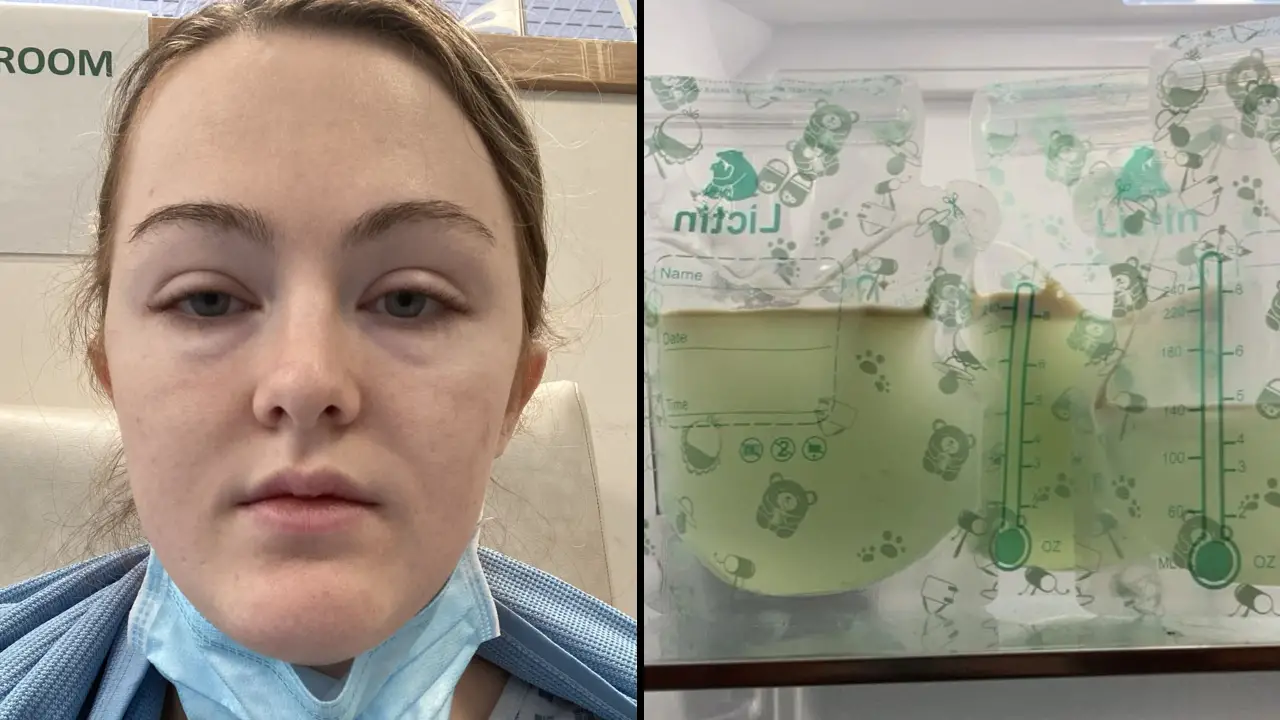 A mom has issued a warning to others after suffering a medical emergency that turned her breast milk green.