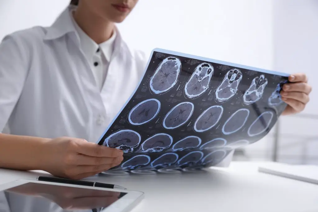 multiple sclerosis