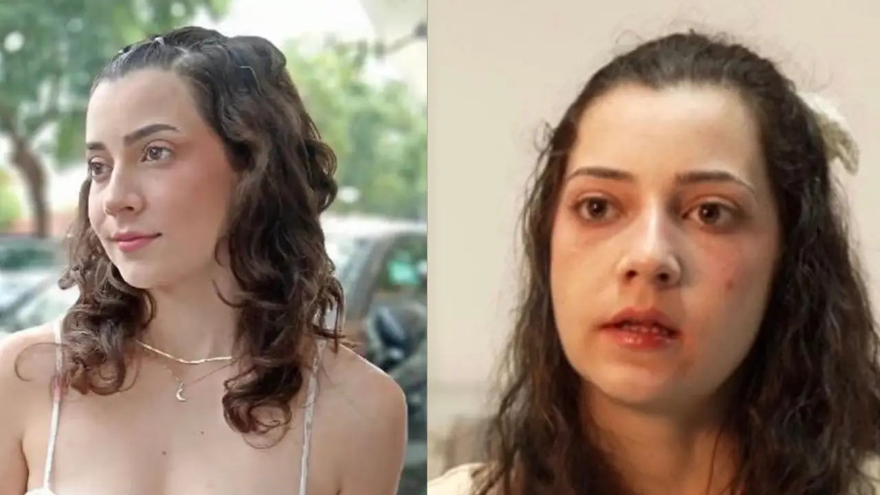 25-Year-Old Woman Explained Why She Chose To Be Euthanized
