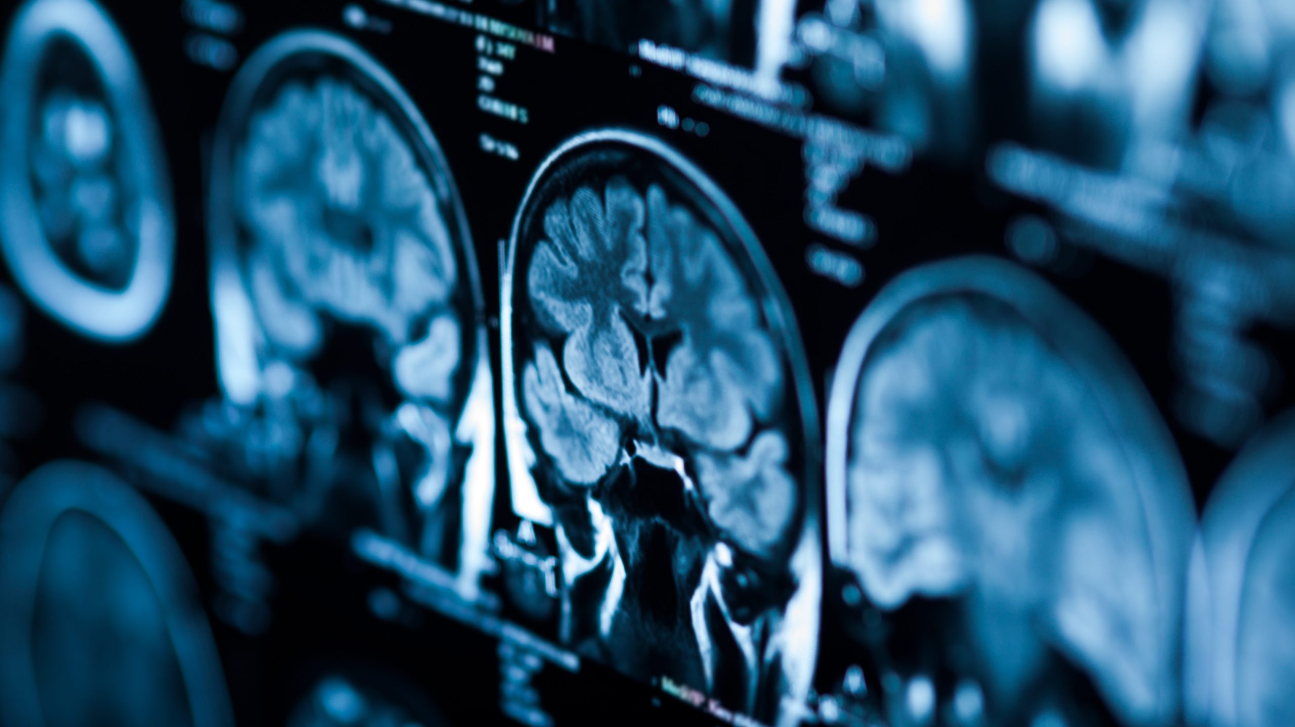 Brain