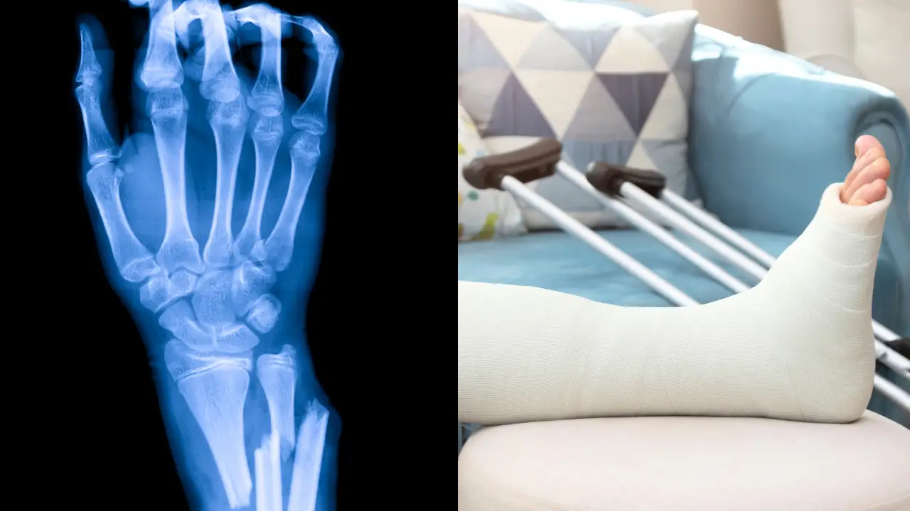 There’s a strange theory spreading online about people who have never broken a bone that could point to more than luck.