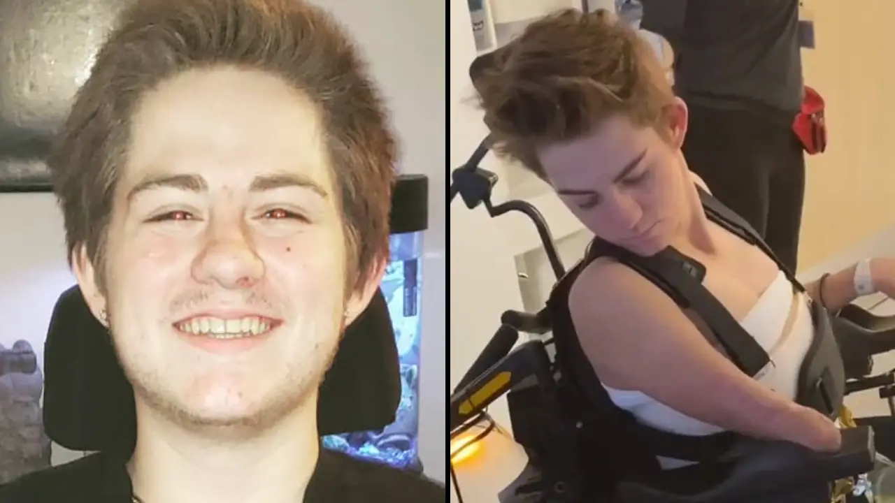 Man Who Was Cut In Half By Forklift Answers The Question Everyone Is Always Asking