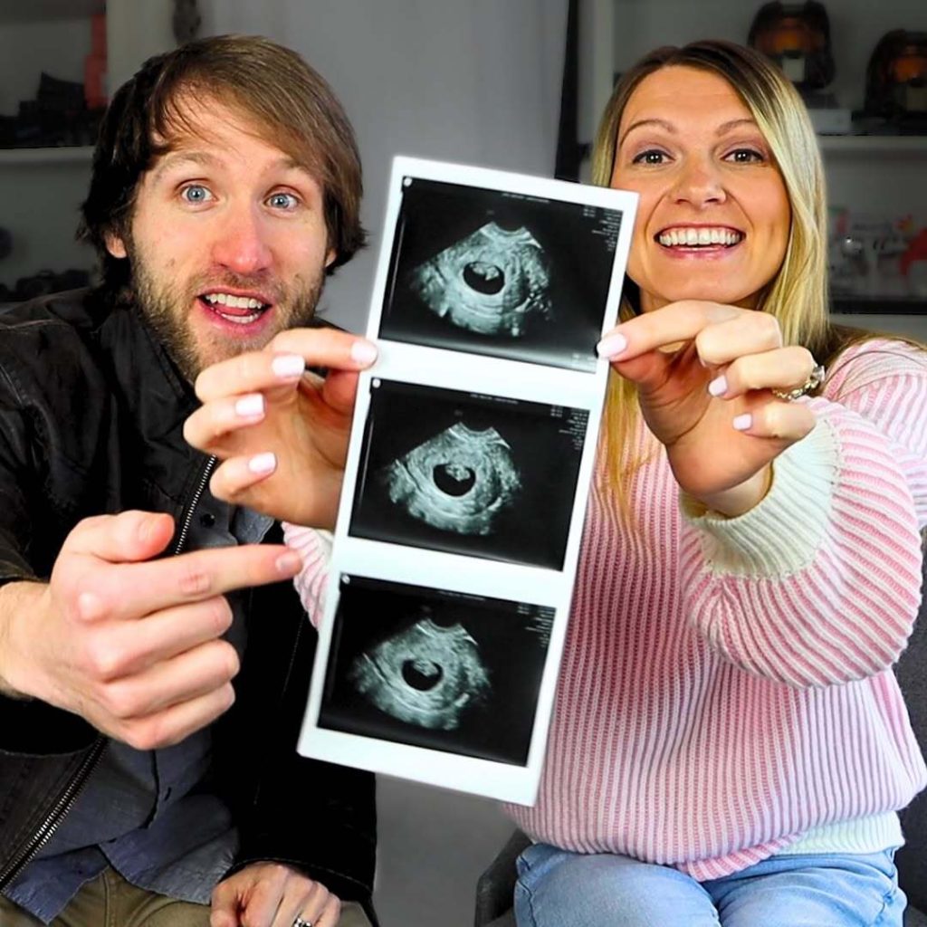 Down Syndrom Pregnancy