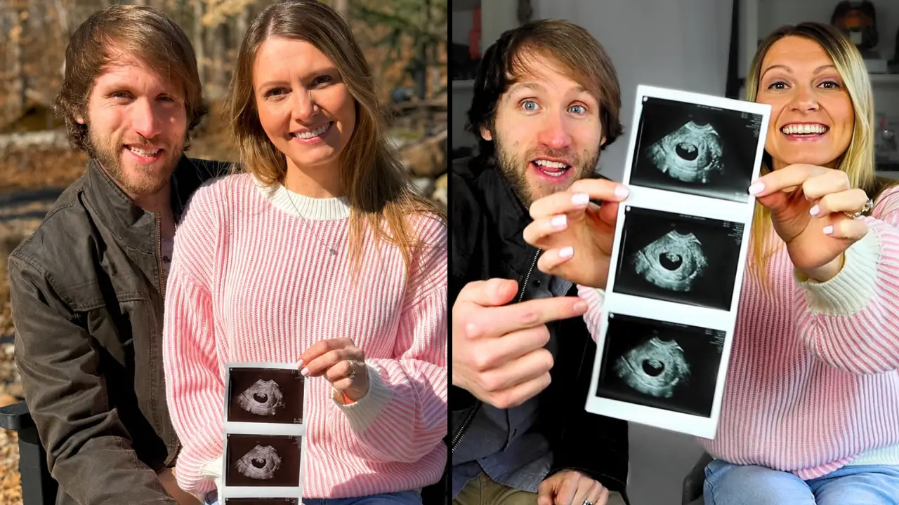 Influencers have responded to backlash after sharing their decision to terminate their pregnancy after a Down syndrome diagnosis.