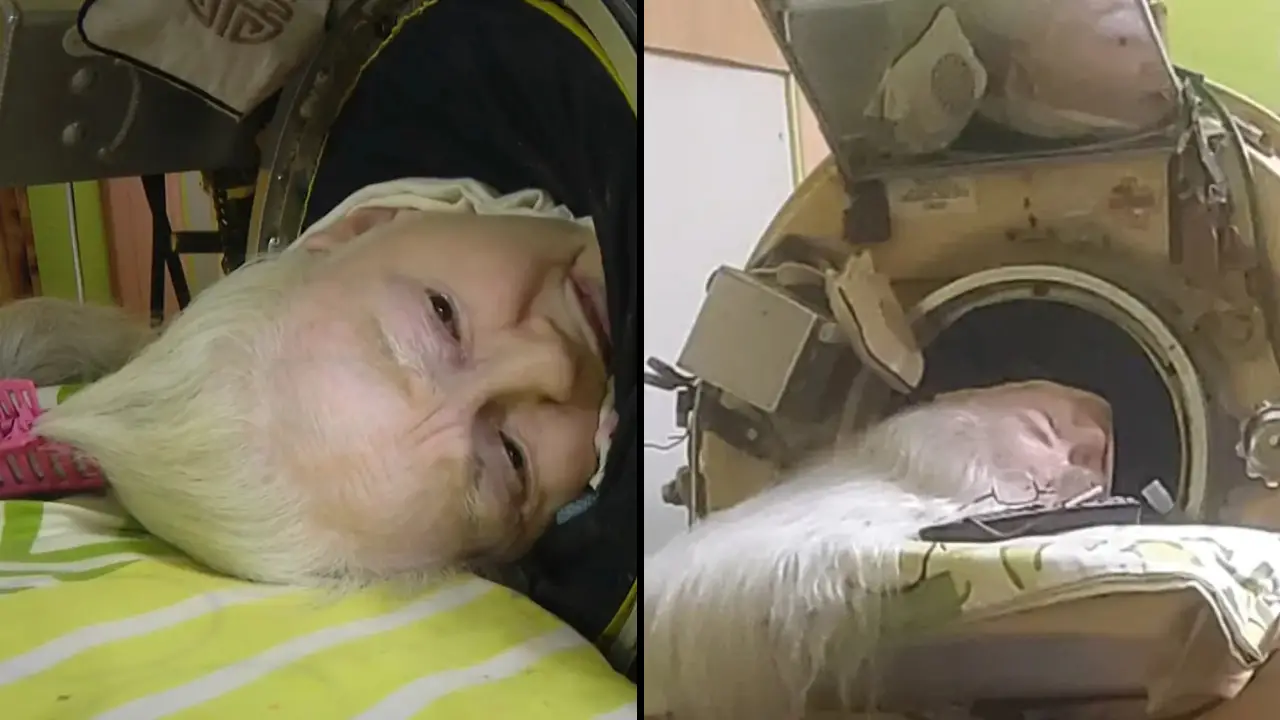 Martha Lillard, a woman who lived inside an iron lung after contracting polio, has died aged 78.