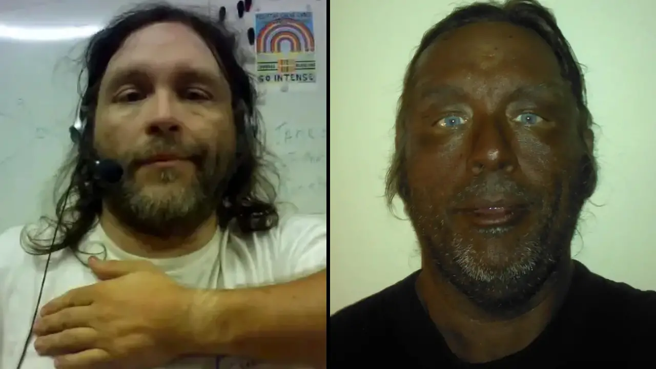 A man who used Melanotan II for years has issued a warning for anyone who's considering trying it.